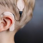 Cochlear implants