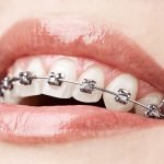 Rittenhouse-Orthodontics