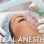 general anesthesia