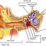 Ototoxicity