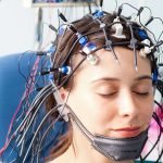 Electroencephalogram EEG